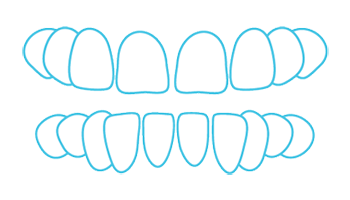 Ilustración de espaciamiento dental
