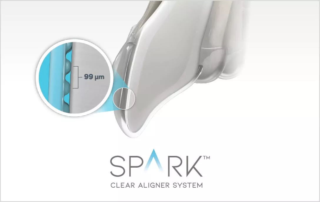 Ampliación del ajuste del alineador Spark, 99 micras